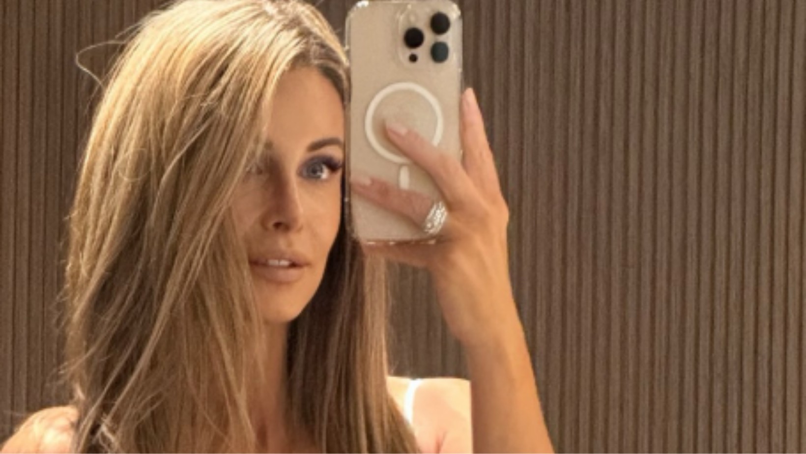 „Po to je robiłam, żeby były zauważone” – Rozenek-Majdan szczerze o operacjach plastycznych