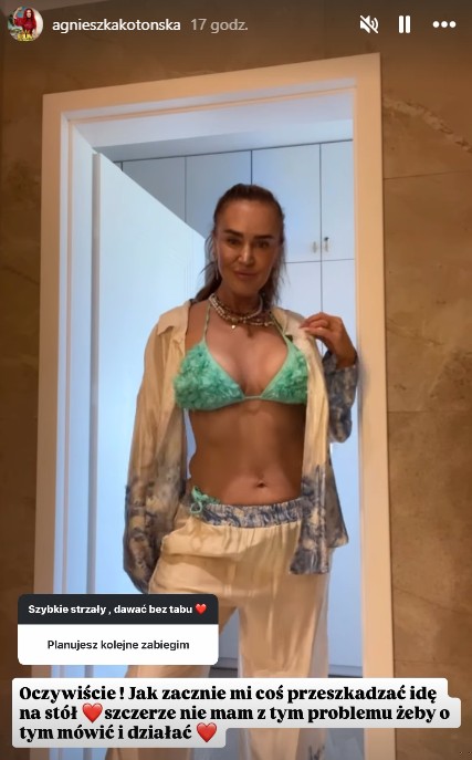 Zdjęcie "Nie chcę starzeć się 'z godnością'" - Agnieszka Kotońska szczerze o operacjach plastycznych #2