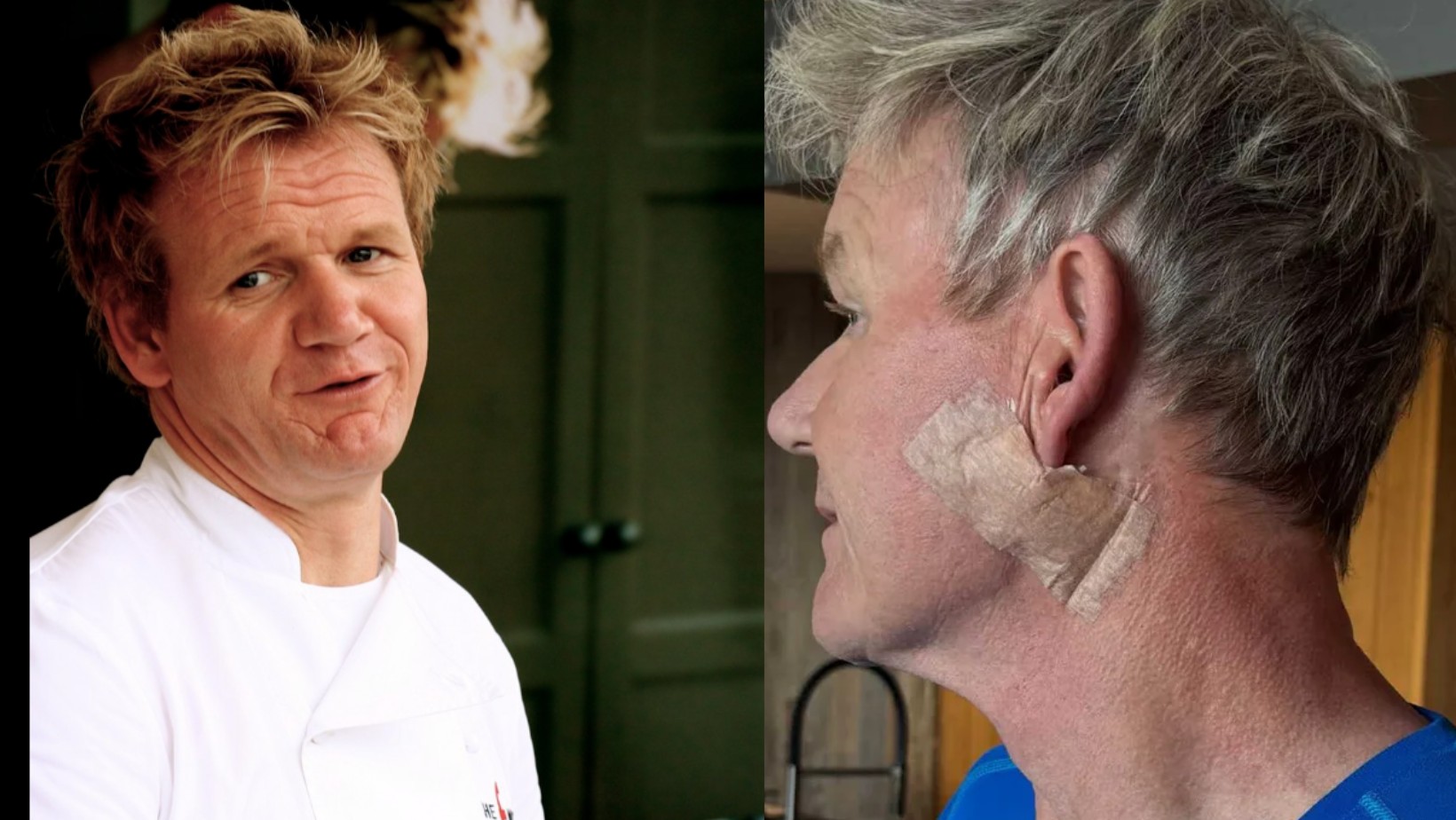 Zdjęcie Gordon Ramsay ujawnił, że zdiagnozowano u niego RAKA SKÓRY! #1