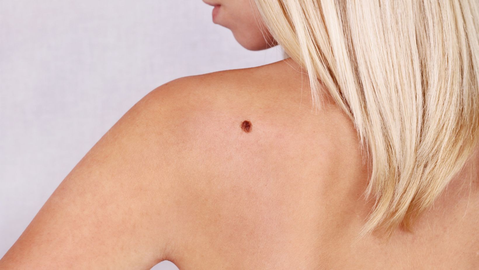 Jakie jest znaczenie pieprzyków? One zdradzają wiele na twój temat!