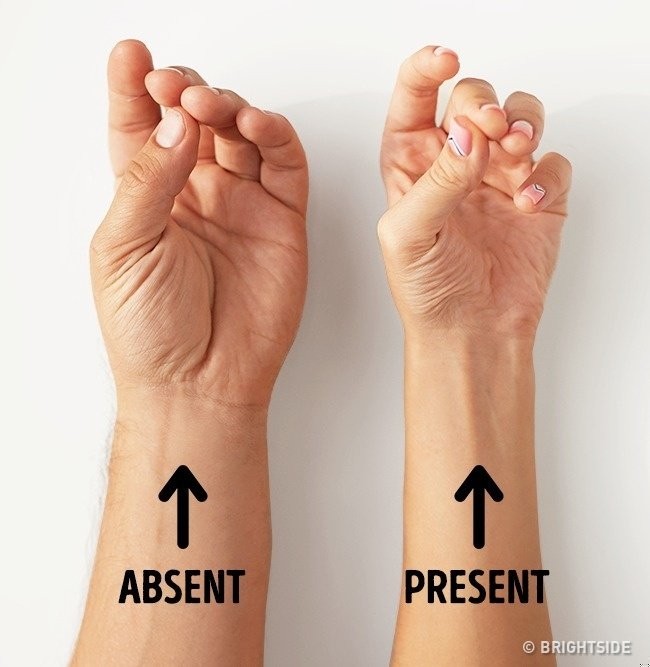 Zdjęcie 11 cech, które świadczą o tym, że twoje ciało jest wyjątkowe! #3