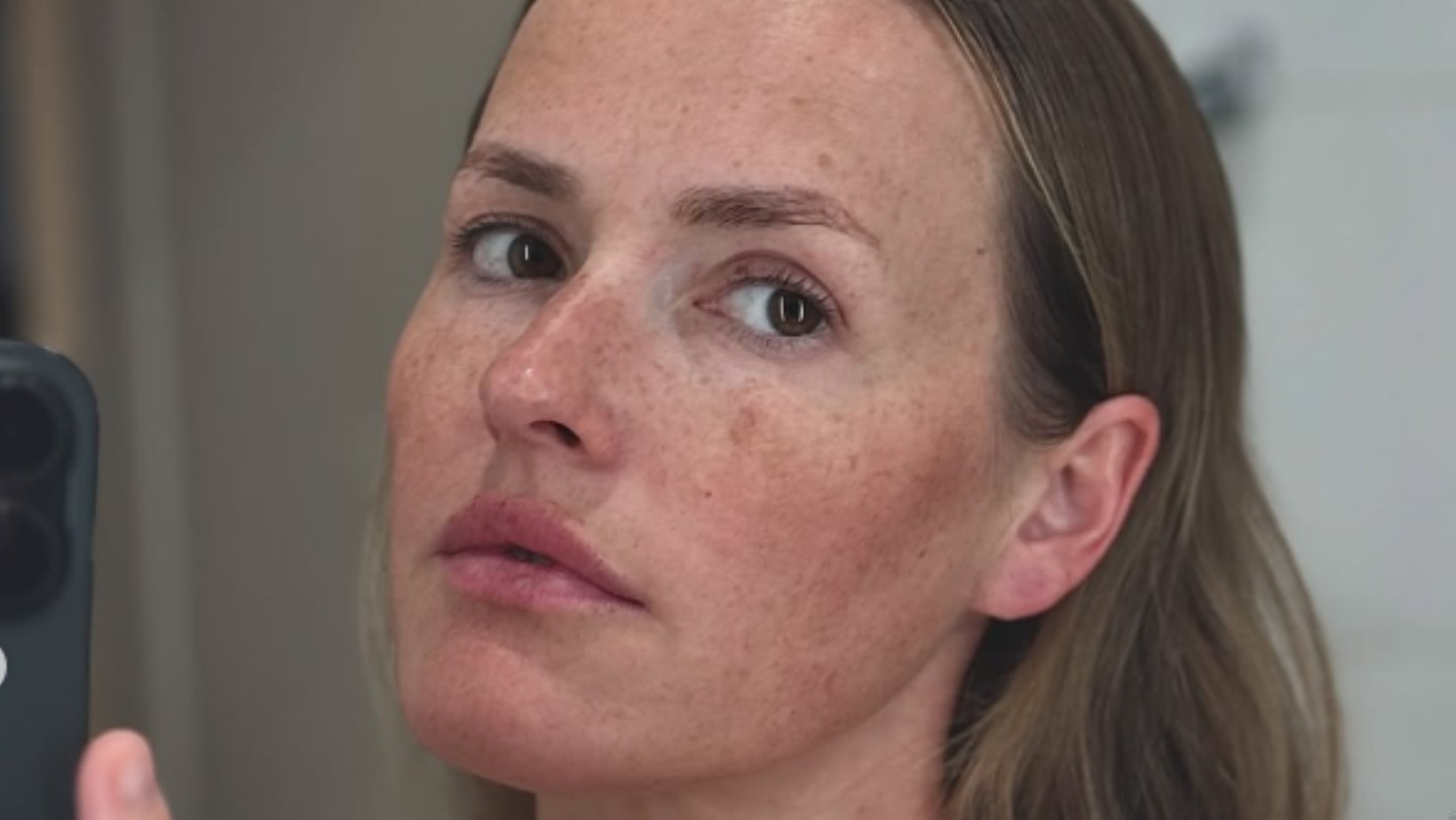 „Żałuję, że to sobie zrobiłam”: Olga Frycz szczerze o skutkach zabiegu estetycznego