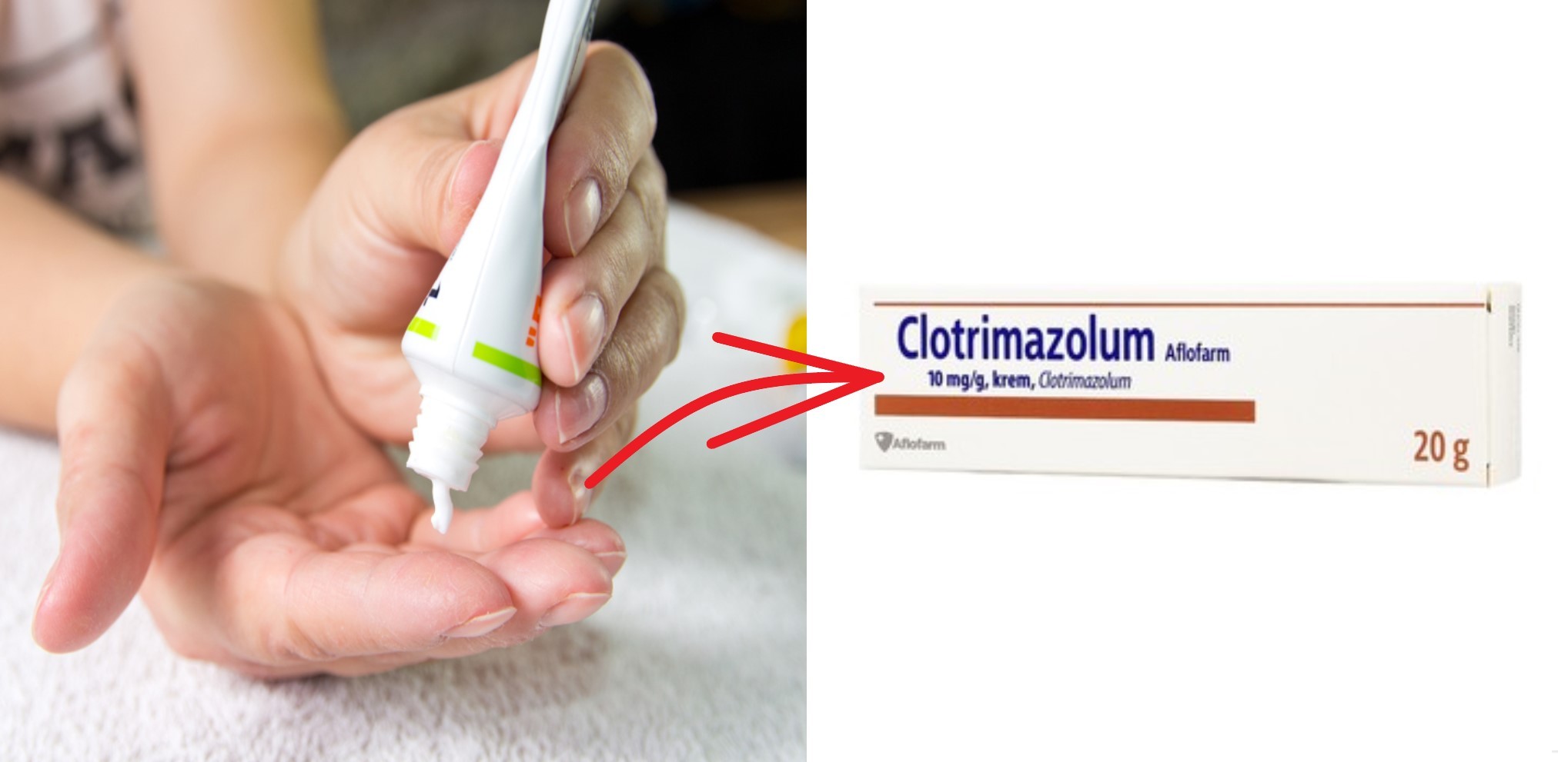 Clotrimazolum – lek do 5 złotych. Jak go stosować, jego skutki i działanie.