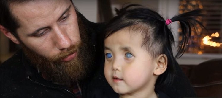 Zdjęcie Wszyscy się jej bali z powodu srebrnych oczu. Dziś ma kochającą rodzinę #2