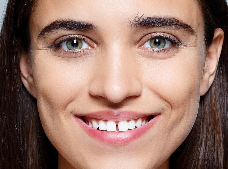 Zdjęcie 11 cech, które świadczą o tym, że twoje ciało jest wyjątkowe! #1