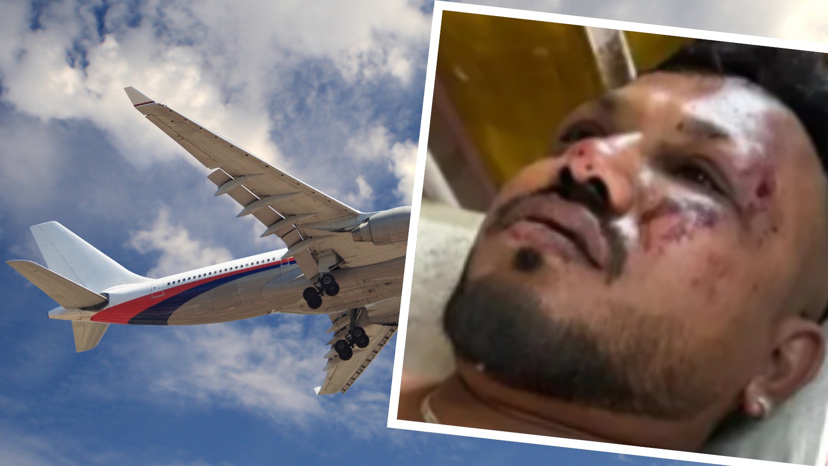 Jedyny ocalały z katastrofy lotniczej mówił o piekle, które przeżył