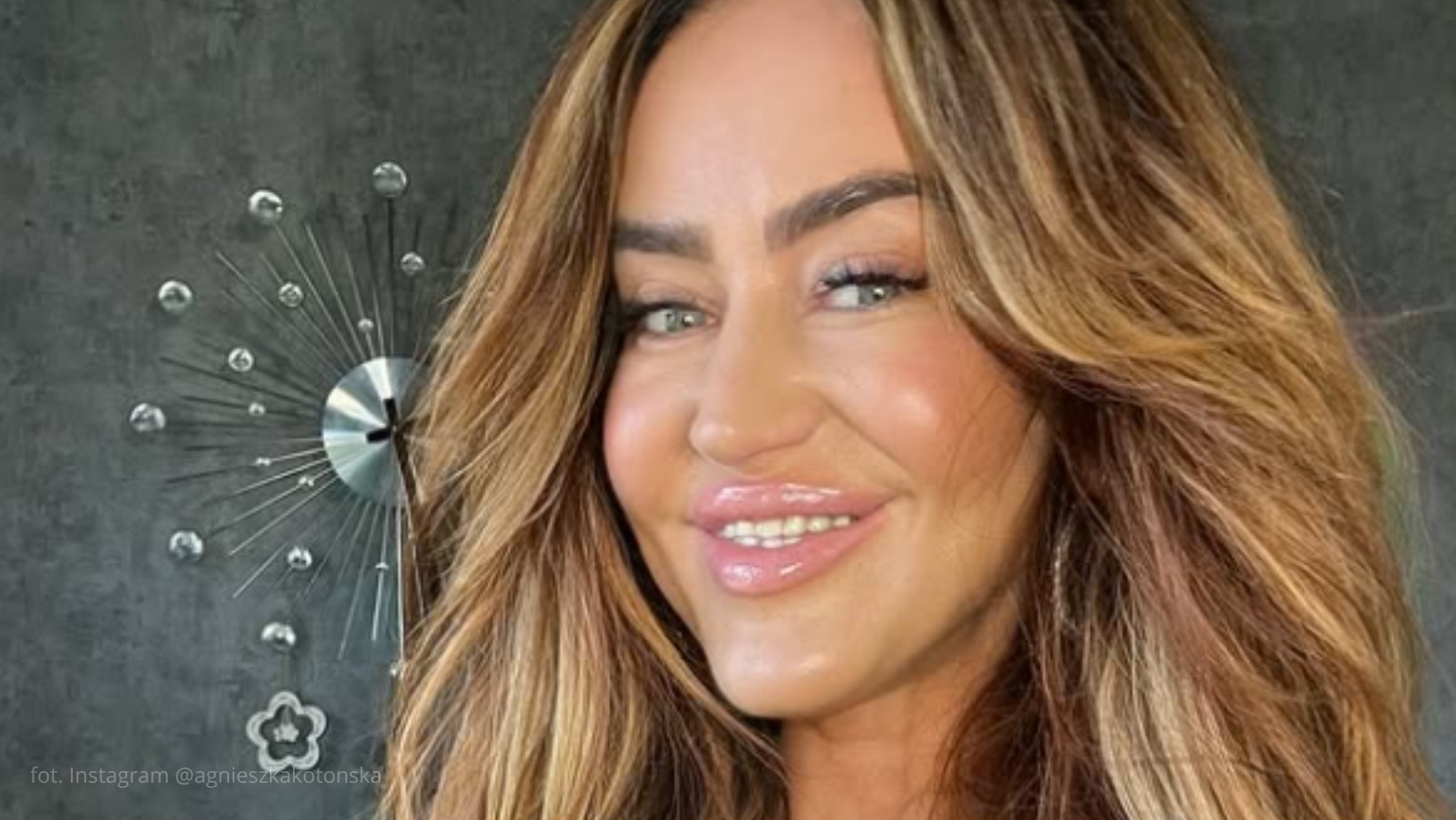 „Nie chcę starzeć się 'z godnością'” – Agnieszka Kotońska szczerze o operacjach plastycznych