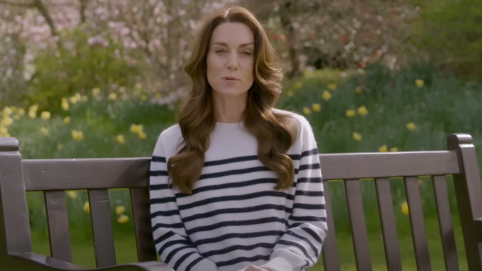 Najnowsze wieści! Stan księżnej Kate jest bardzo poważny?