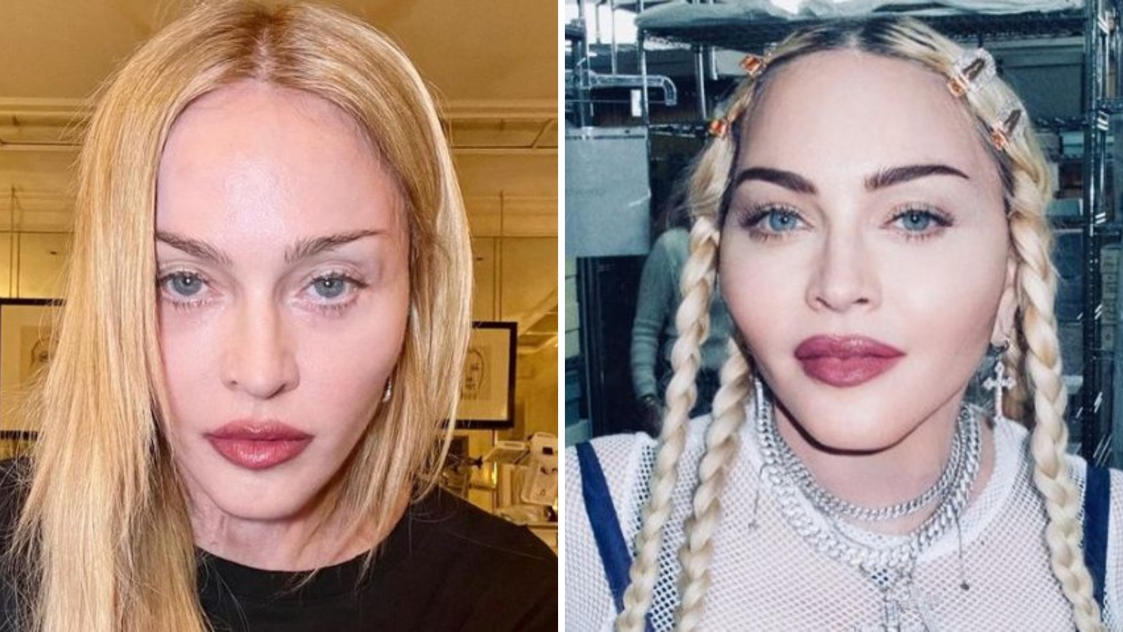 Madonna pokazała zdjęcie po wyjściu ze szpitala: „Dziękuję”