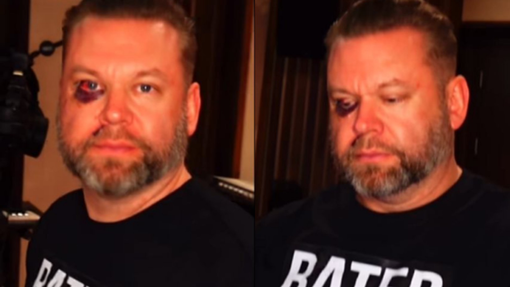 Zdjęcie Znany polski muzyk brutalnie pobity. Stanął w obronie kobiety! #1