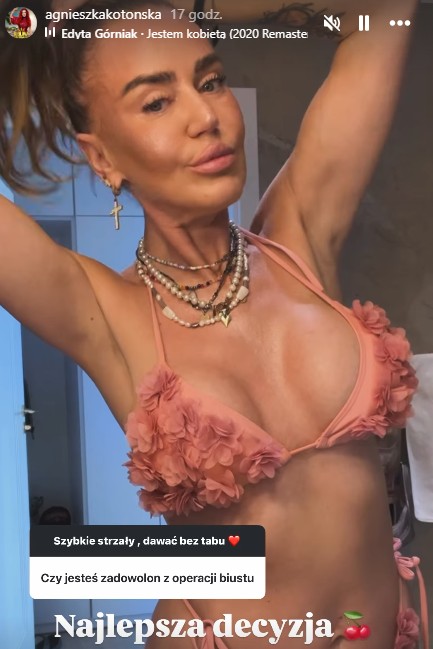 Zdjęcie "Nie chcę starzeć się 'z godnością'" - Agnieszka Kotońska szczerze o operacjach plastycznych #1