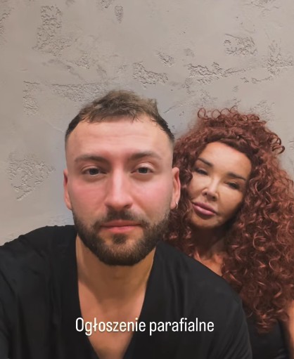 Zdjęcie Katastrofa przed startem „Tańca z Gwiazdami”! Eva Minge złamała żebra #1