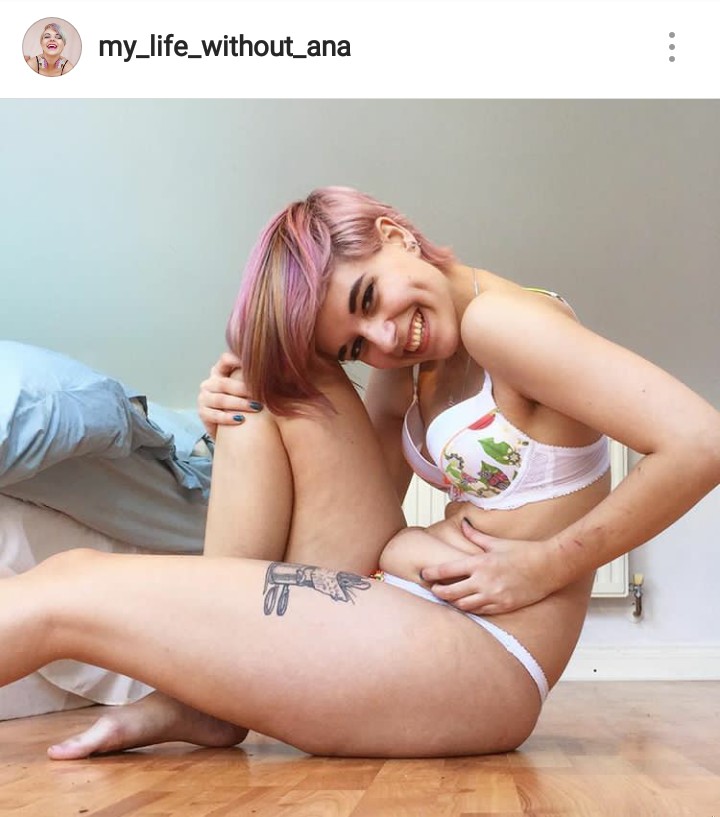 Zdjęcie „Nie dbałam o życie, śmierć” anoreksja prawie odebrała jej życie, teraz motywuje do walki z chorobą #1