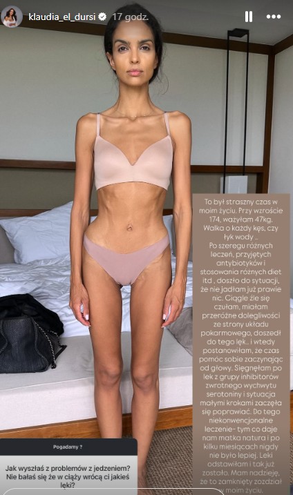 Zdjęcie “Przy wzroście 174 cm ważyłam 47 kg”: Klaudia El Dursi pokazała  szokujące zdjęcie... #1
