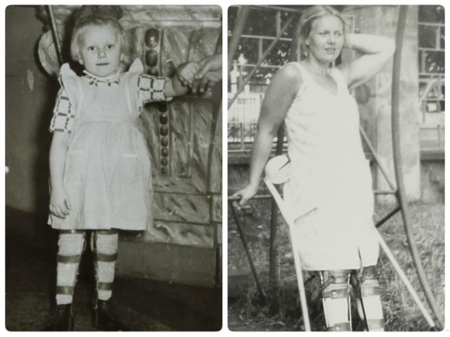 Zdjęcie Wzruszający gest papieża Franciszka. Zapłaci za windę Polki chorej na polio. #2