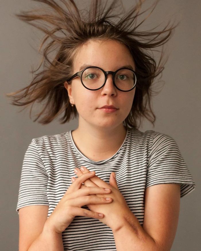 Zdjęcie Sfotografowała ludzi z bliznami oraz poprosiła, aby podzielili się ich historią #7