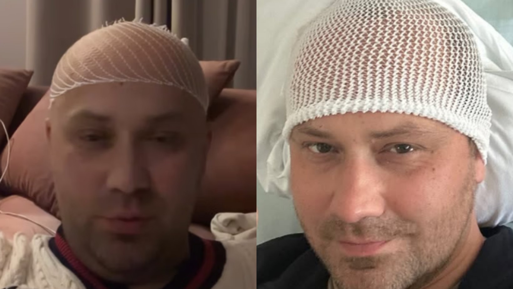 Zdjęcie Adrian Szymaniak po drugiej operacji mózgu. „Rokowania niekorzystne” – szczere wyznanie #1