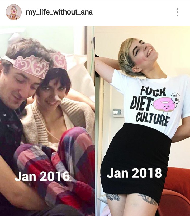 Zdjęcie „Nie dbałam o życie, śmierć” anoreksja prawie odebrała jej życie, teraz motywuje do walki z chorobą #2