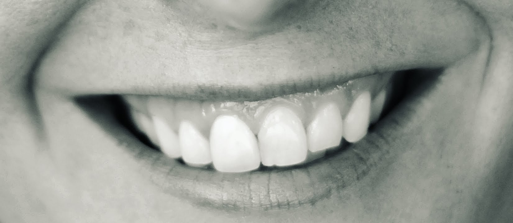 Umrzeć ze śmiechem na ustach to z pewnością najchwalebniejszy ze …